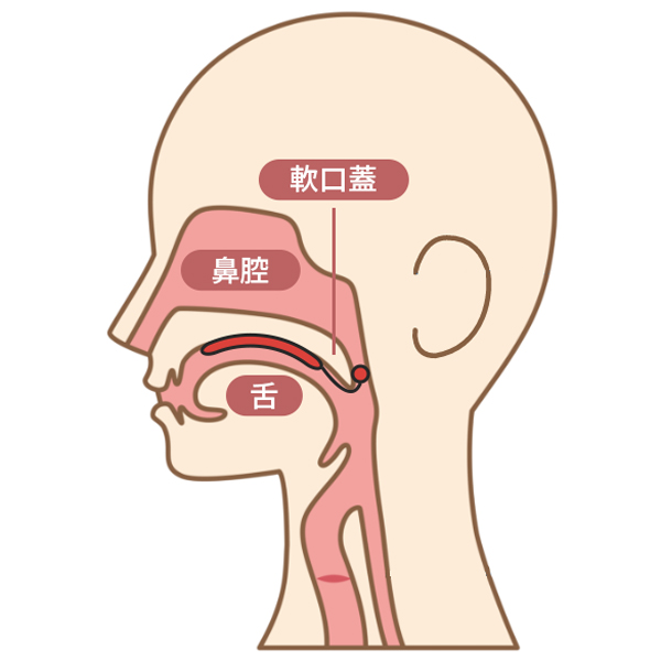 スピーチエイド概要図